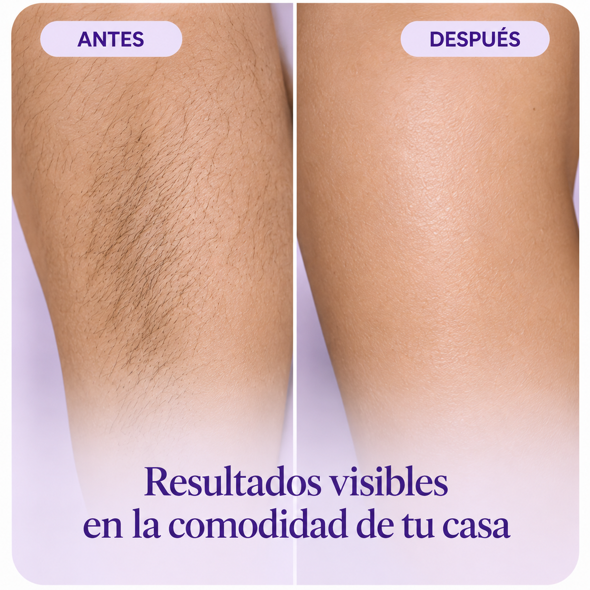Silk&Habit™ — Crema Depilatoria